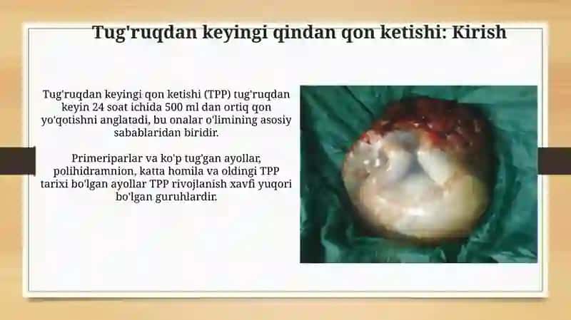 Tug'ruqda qin qon ketishlar.Bachadon yorilishi. Tashxislash. Xavf guruxi. Oldini olish. 3