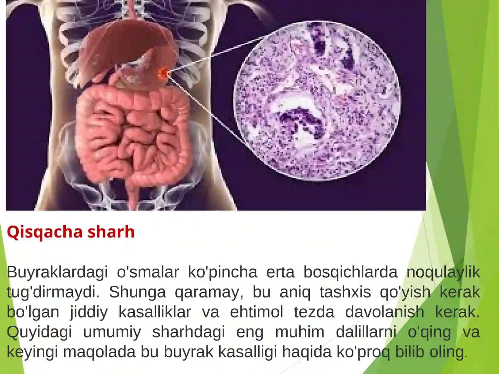 Buyrak O’salari 3