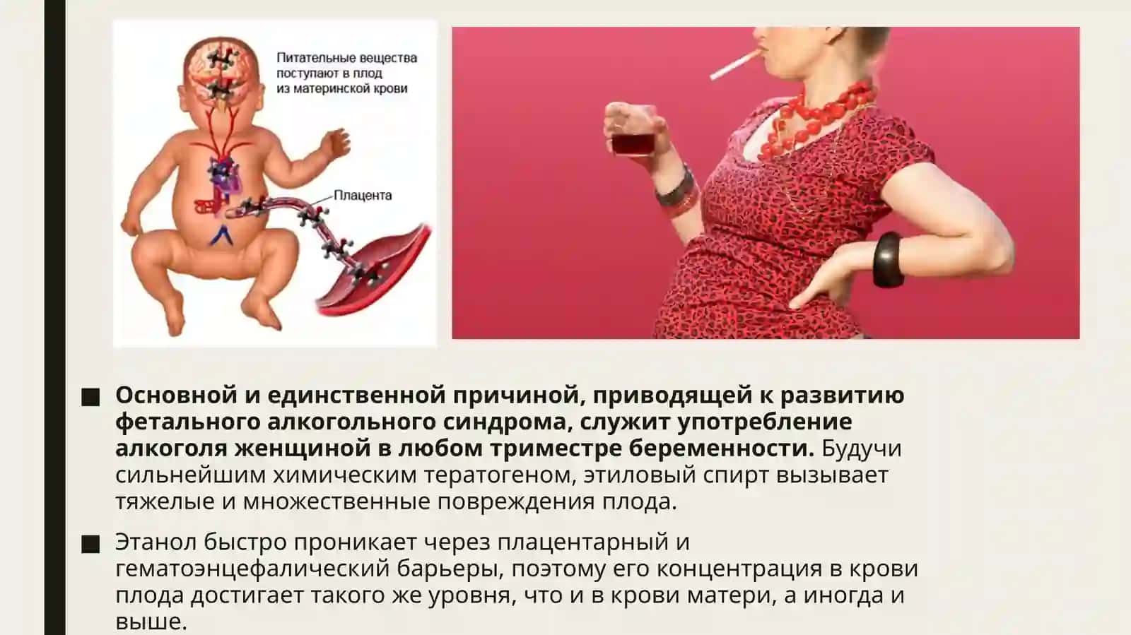 Фетальный алкогольный синдром. (Симптомы и Причины) 3