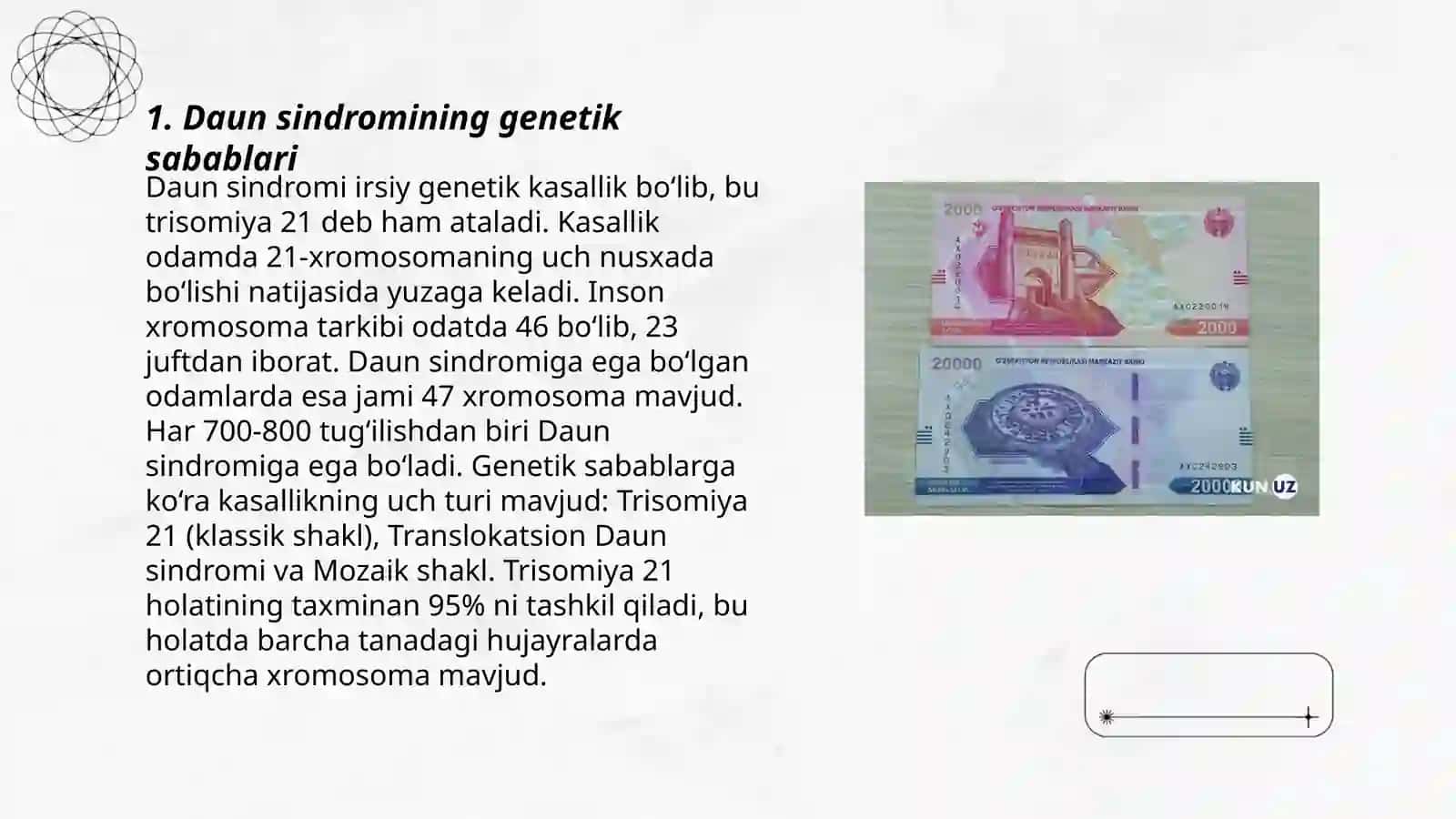 Daun sindromli bolalar haqida 3