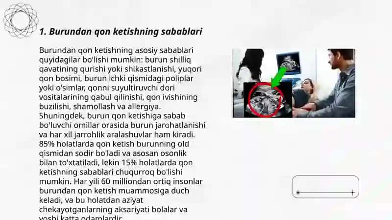 Burundan qon ketish etiologiyasi, klinikasi, tashxislash va davosi 3