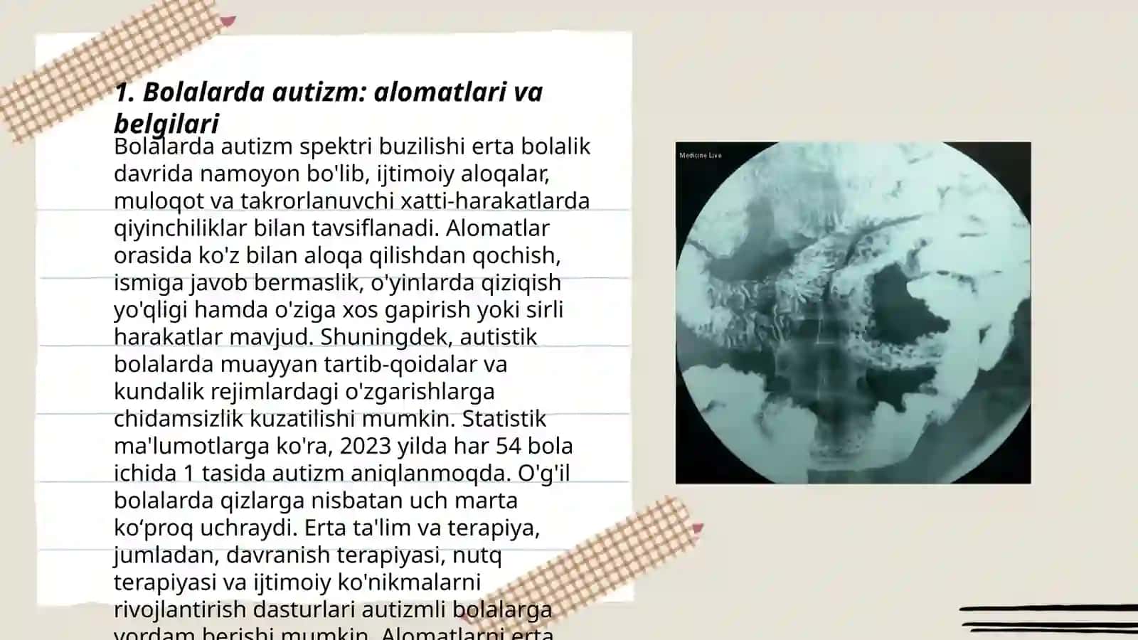 Bolalar kasalliklari Autizm va Daun sindiromi 3