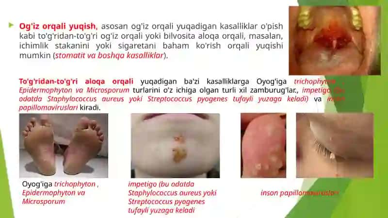 Infeksiya haqida 3