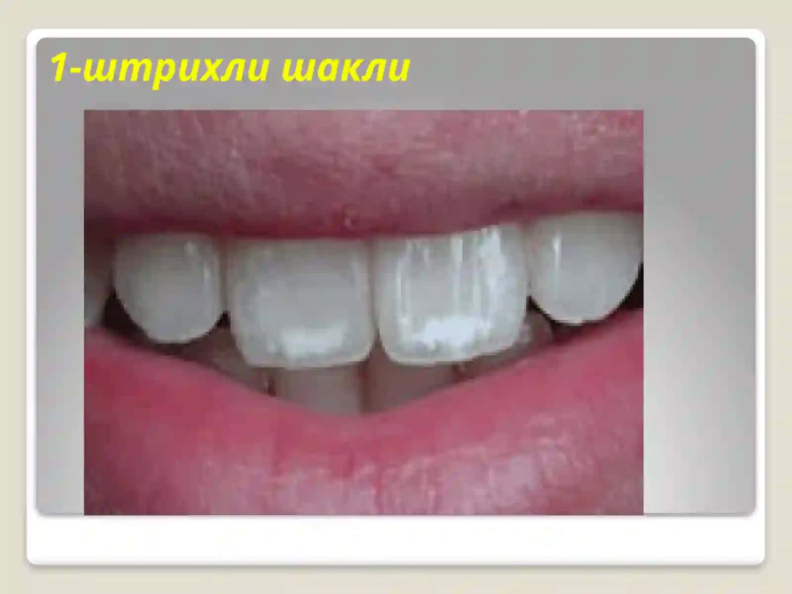 Флюороз 3
