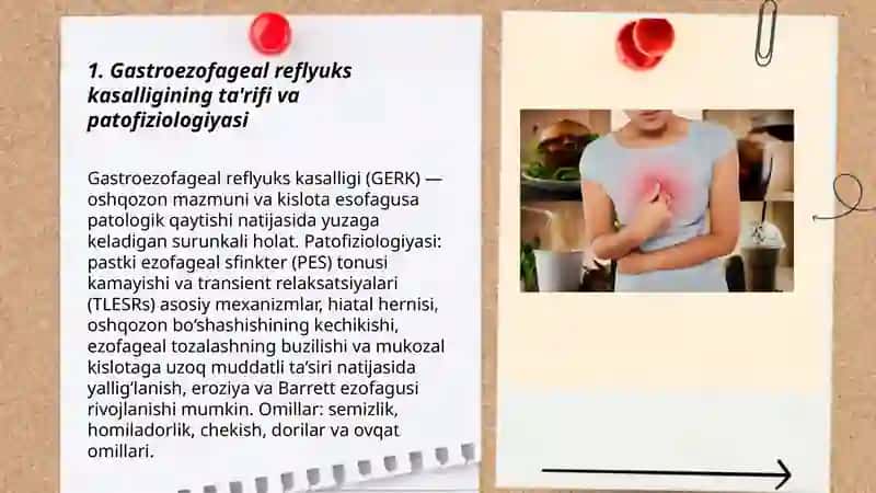 Gastroezofageal reflyuks kasalligi 3