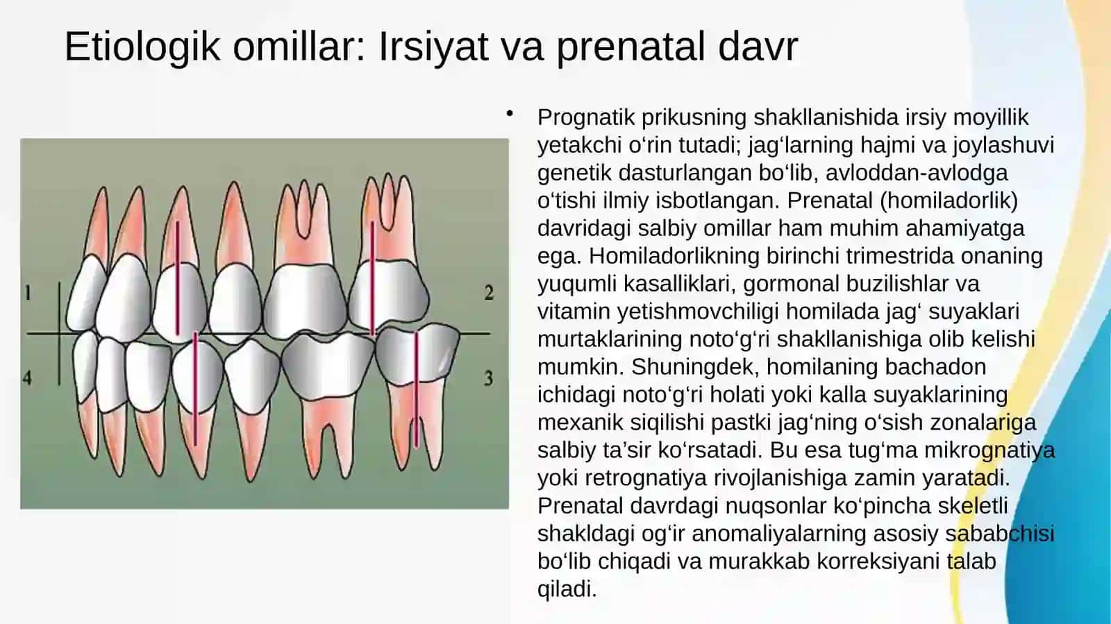Prognatik prikus. Prognatik prikusning shakllanishi. Etiologiya va patogenezi. Klinikasi, tekshirish va davolash usullari. 3