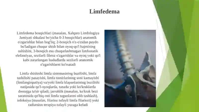Limfa tug'un patalogik anatomiyasi 3