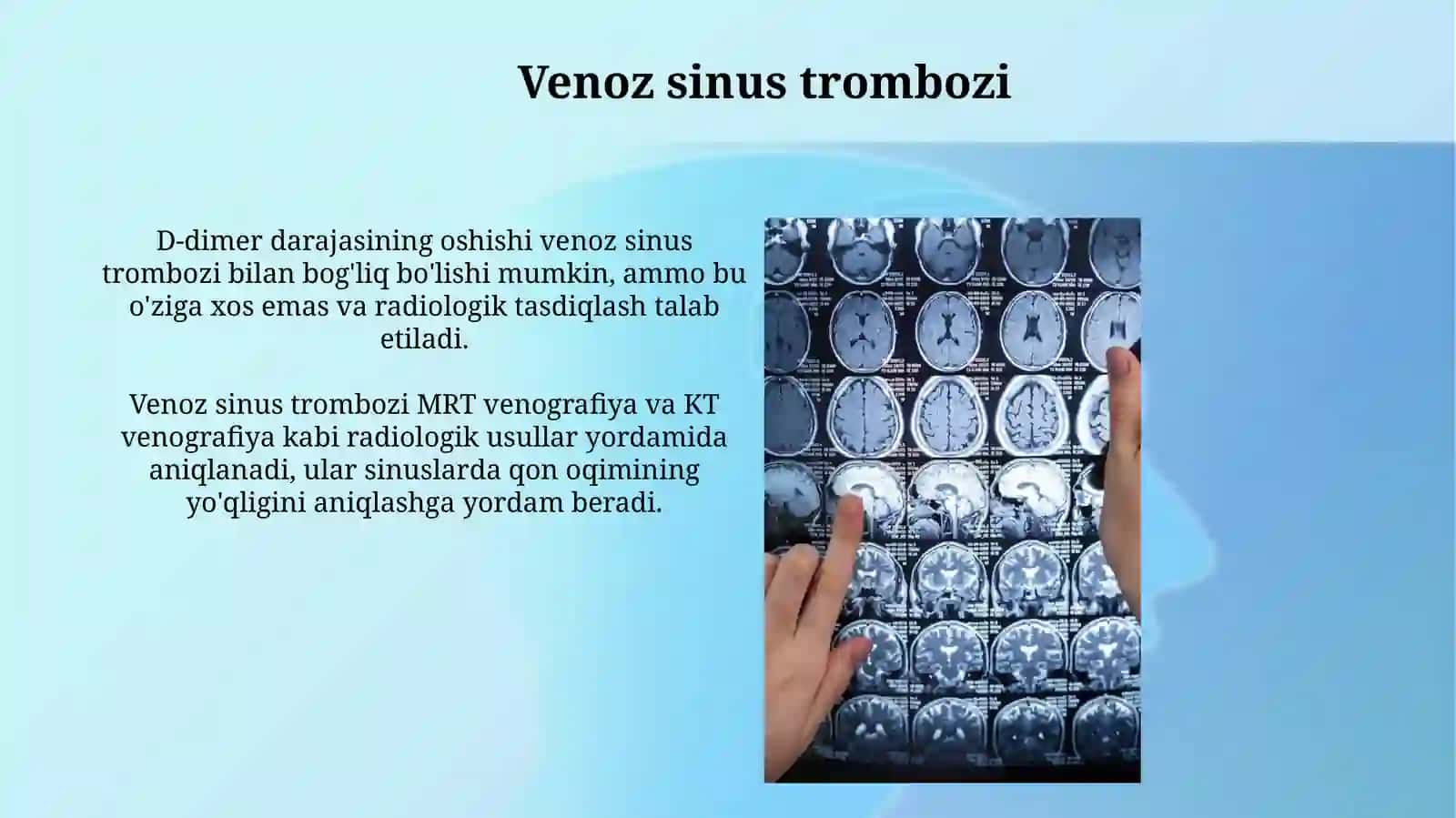 Bosh miyya qon tomir kasalliklari.Radiologiyasi 3