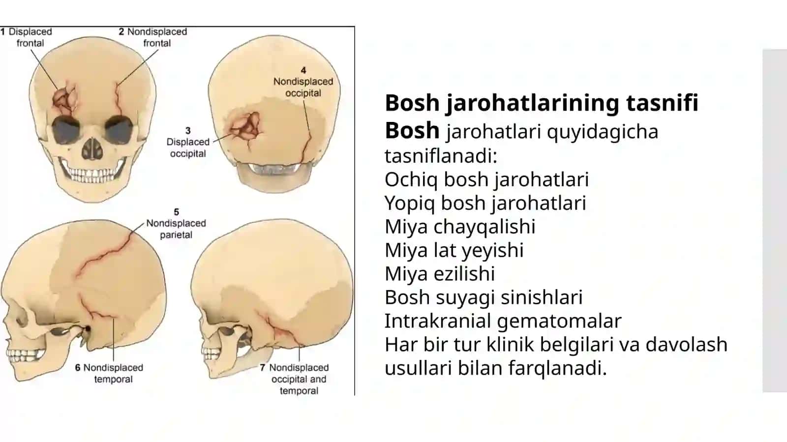 Boshning ochiq jarohatlari va yopiq shikastlari | Tibbiy PowerPoint (PPT) taqdimoti | Tibbiyot talab 3