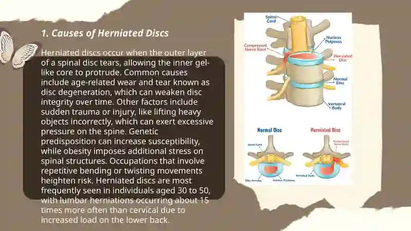 Herniated disc 3