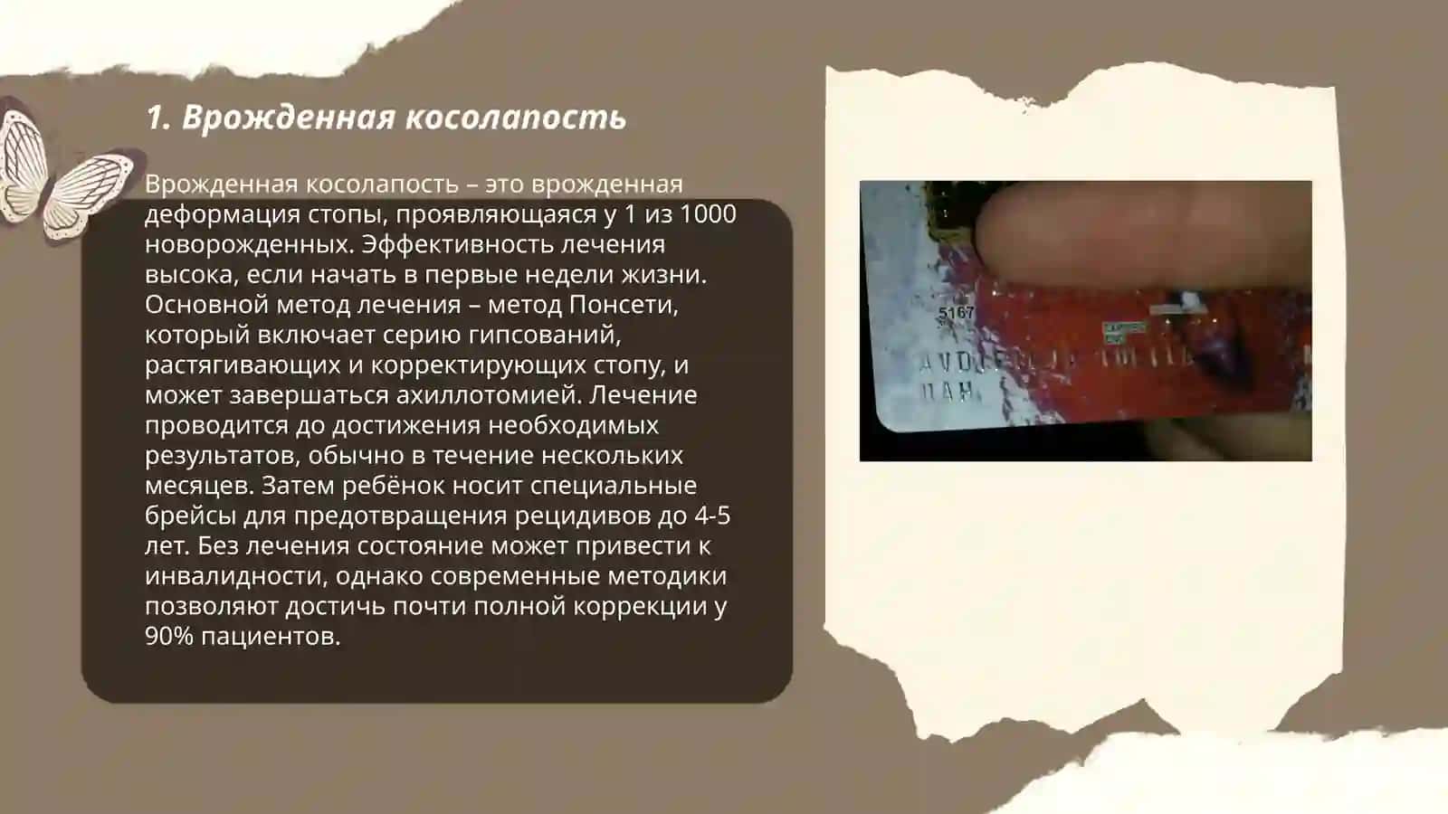 Аномалии развития скелета 3