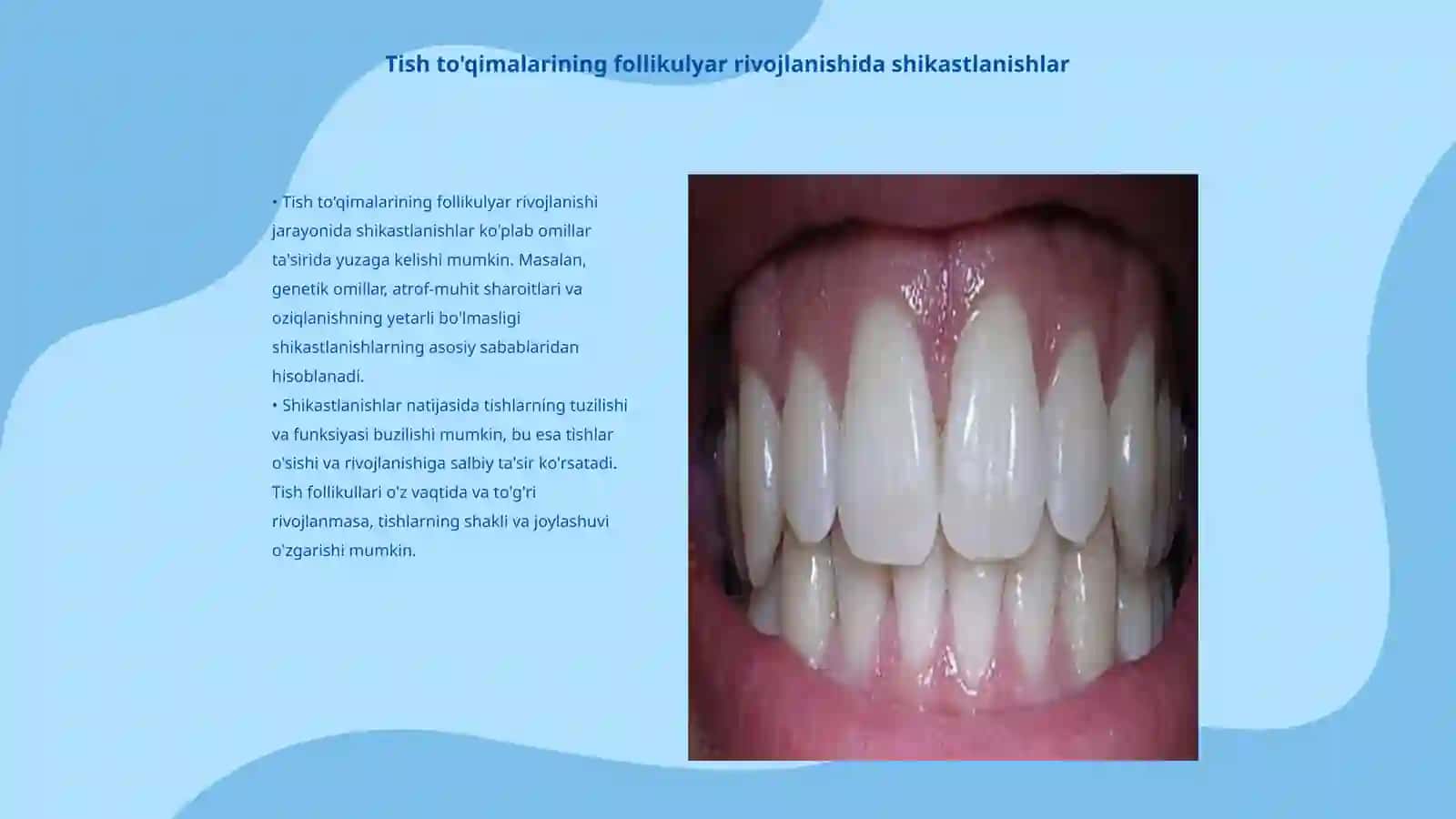 Tish to'qimalarining follikulyar rivojlanishi 3