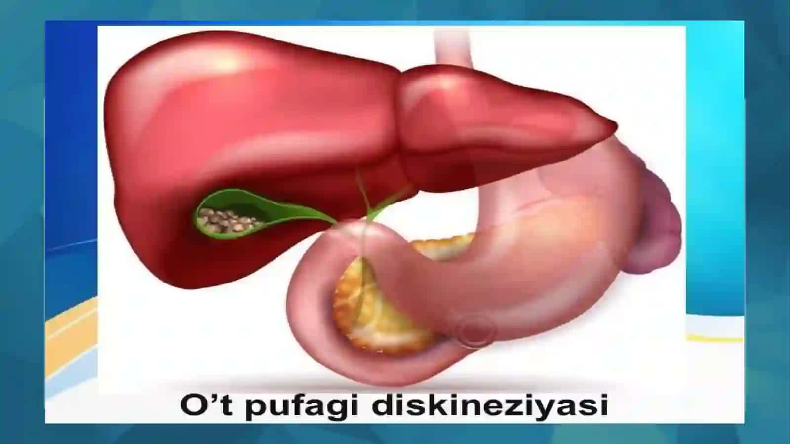 O't yoʻllari diskenezi 3