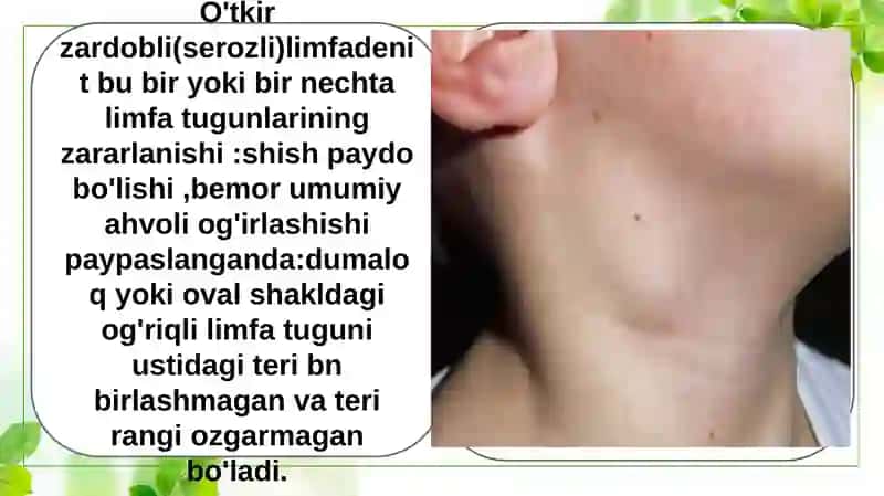 Bolalardayuzyumshoqto'qimalariningodontogenyallig'lanishjarayonlari 3
