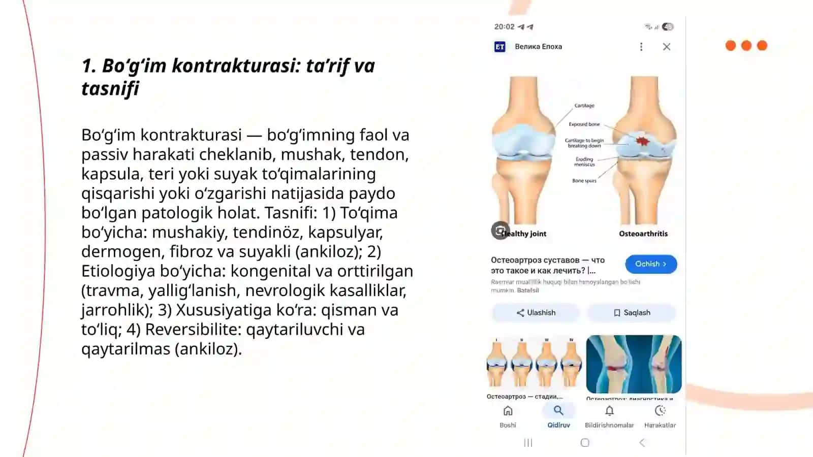 Bo‘g‘imlar kontraktura va ankilozlari 3
