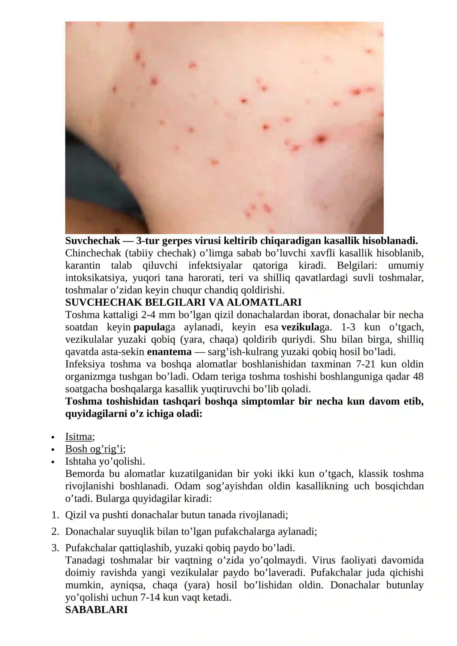 QIZAMIQ, SUCHECHAK VA SKARLATINA KASALLIKLARI 3