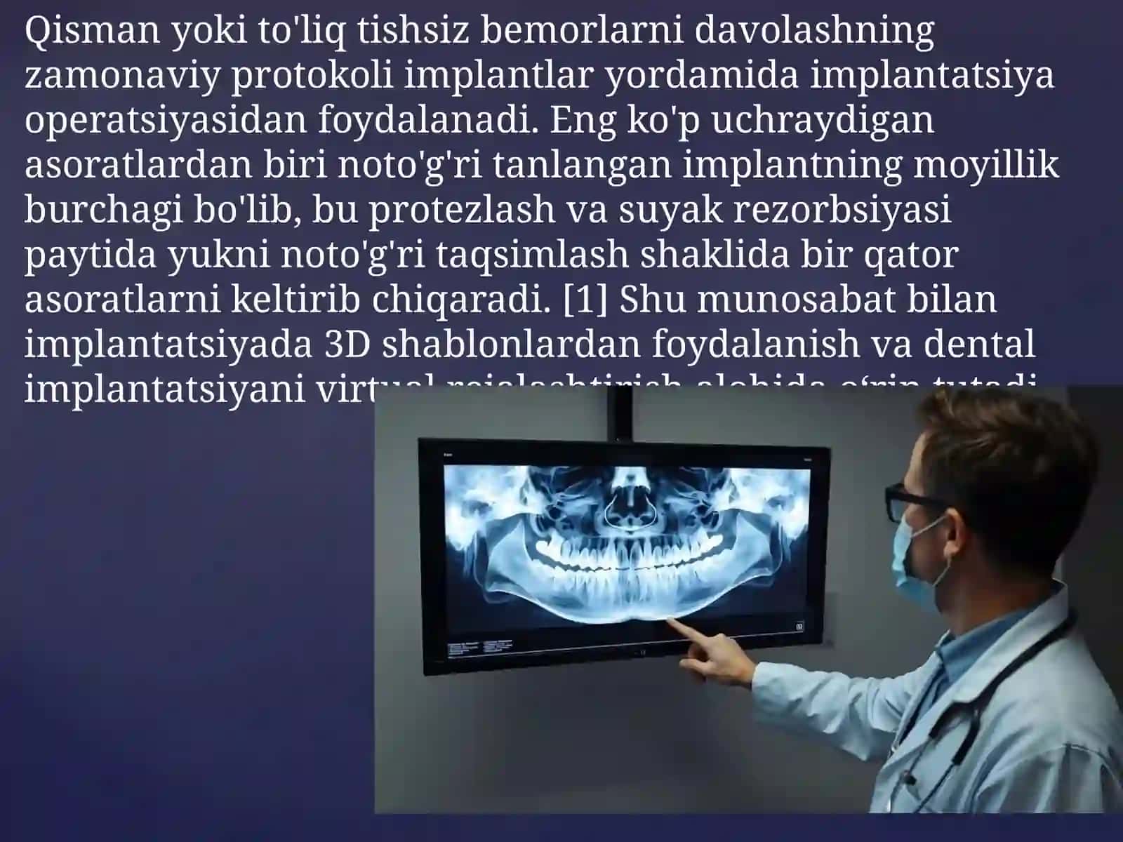 KLIKTasosida dental implantatsiyani 3D rejallash 3