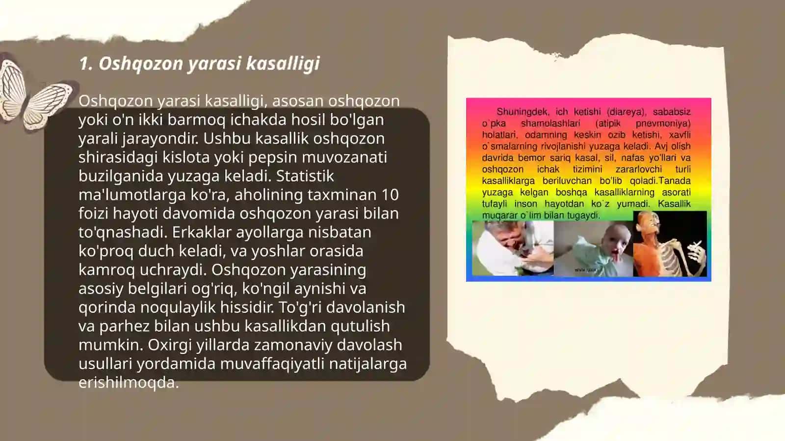 Gastraenterologiyada dolzarb kasalliklar 3