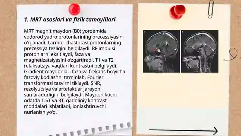 Zamonaviy tekshirish usullari.MRT, MSKT, KT, qon tomir dopplerografiyasi 3