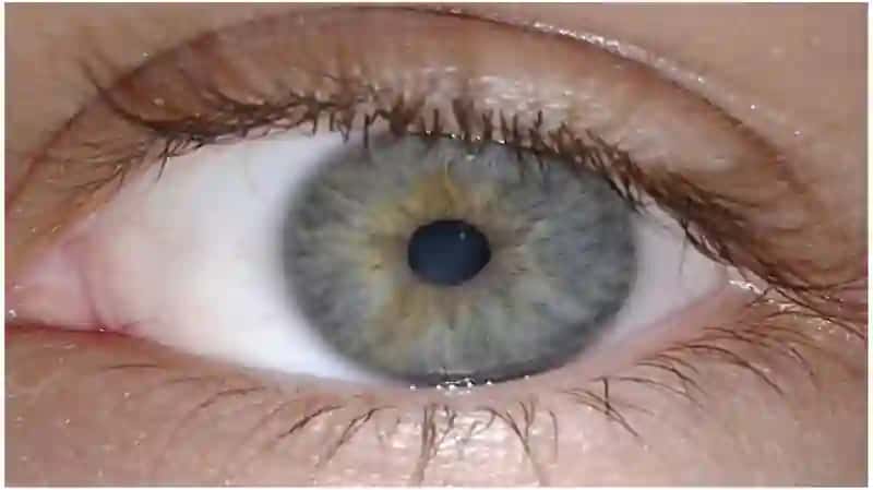 Koʻzning optik tizimi. Ko'z kasalliklari 3