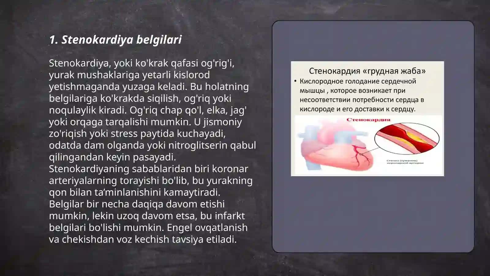 Stenokardiya 3