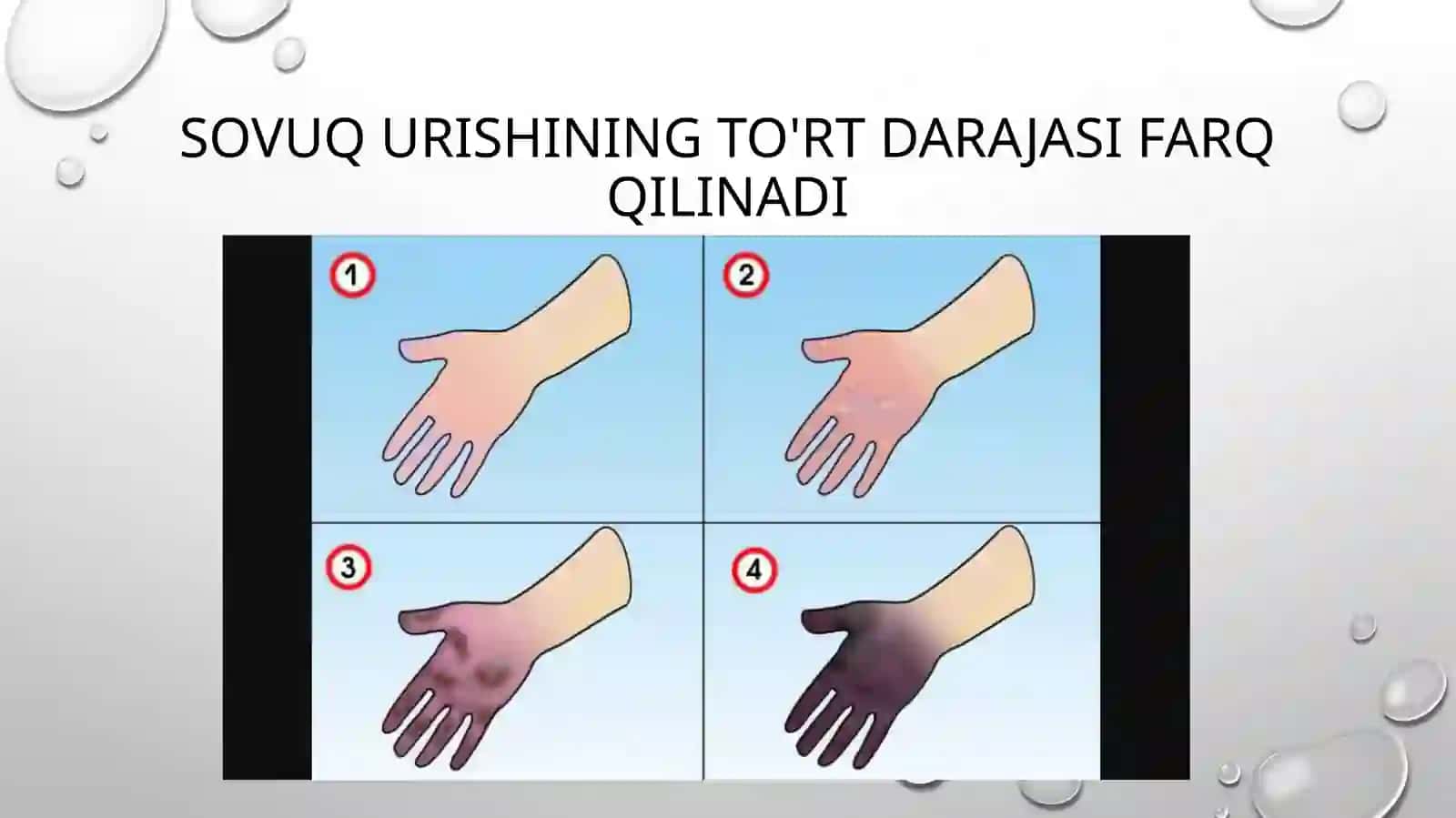Sovuq urishi 3