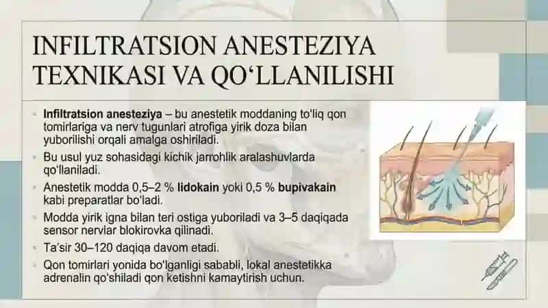 Yuz sohasida bajariladigan mahalliy, o'tkazuvchi og'riqsizlantirishlar texnikasi. Yuz-jag sohasida 3