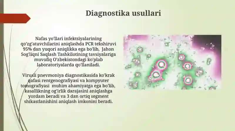 Havodagi tomchi infektsiyalari 3