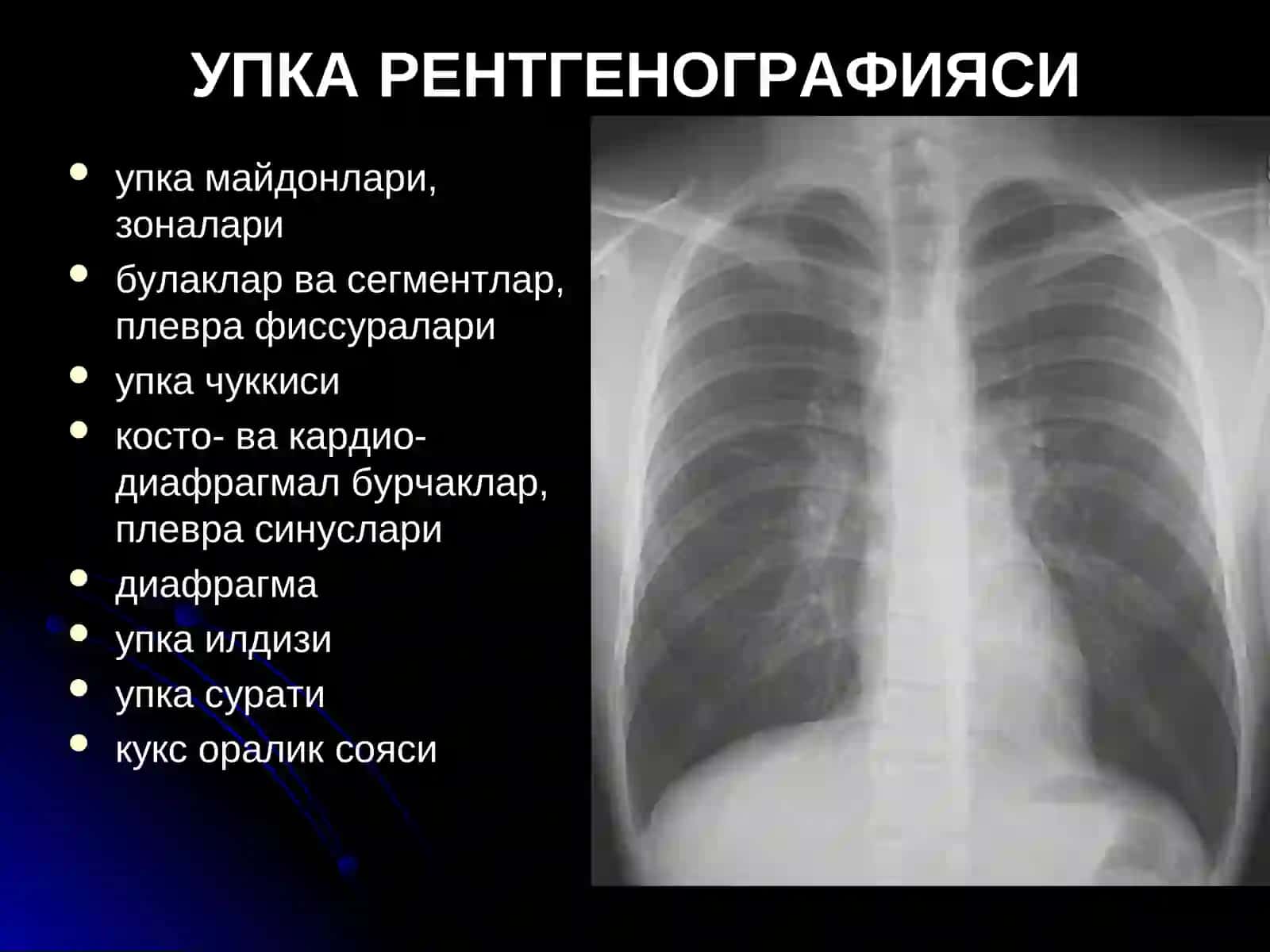 УПКА КАСАЛЛИКЛАРИНИНГ НУР ТАШХИСИ 3
