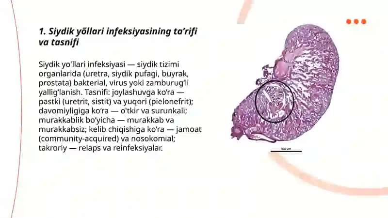 Siydik yõllari infeksiyasi 3