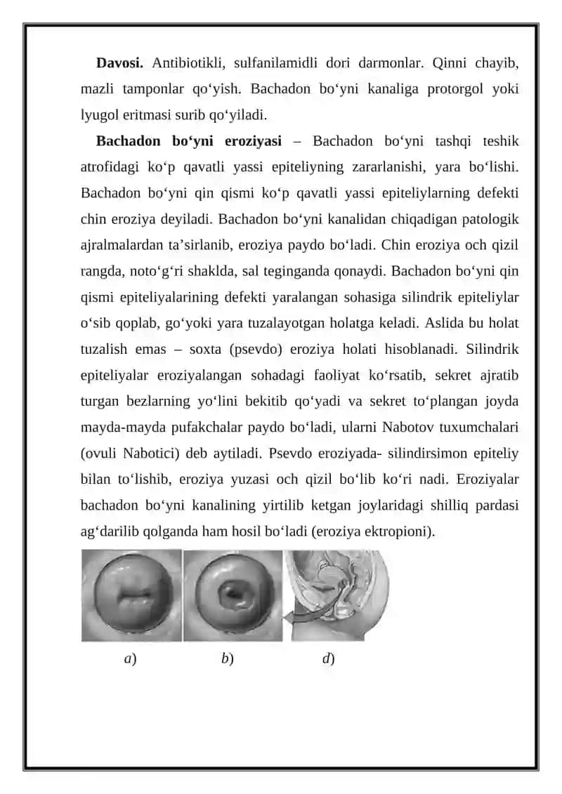 Ayollar jinsiy a'zolari spesifik va nospesifik kasalliklari 3