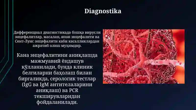 Kana ensefaliti etiologiyasi klinikasi patogenez davolashi 3