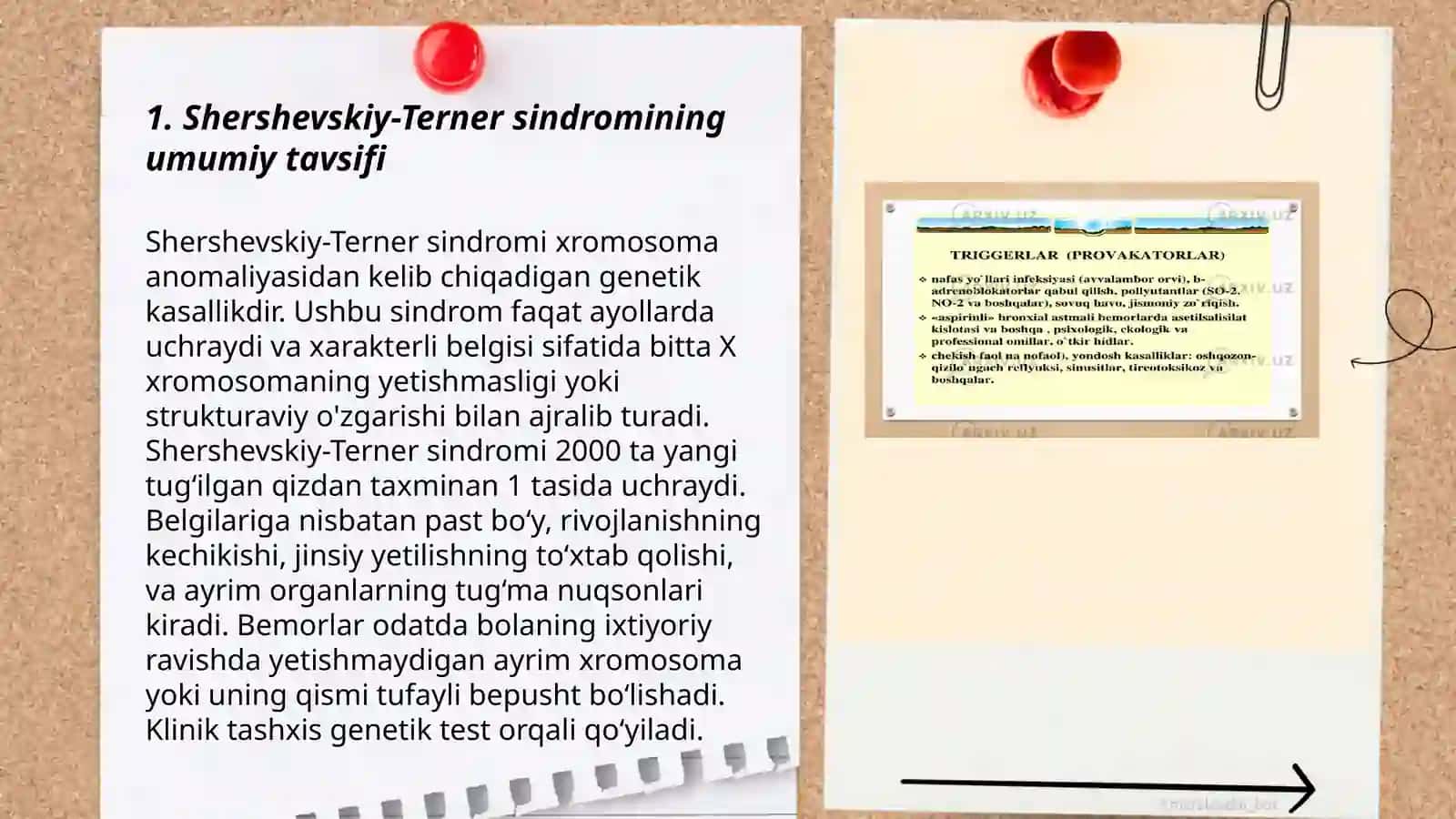 Shersbevskiy-Terner sindromi, patogenezi, etiologiyasi va davolash usullari 3