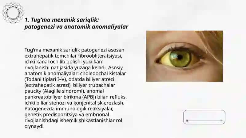 Tugʻma va orttirilgan mexanik sariqlik 3