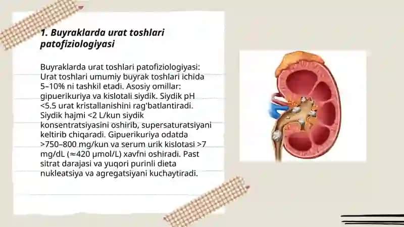 Buyraklarda urat toshlarini hosil bo'lishi va davolash yo'llari 3