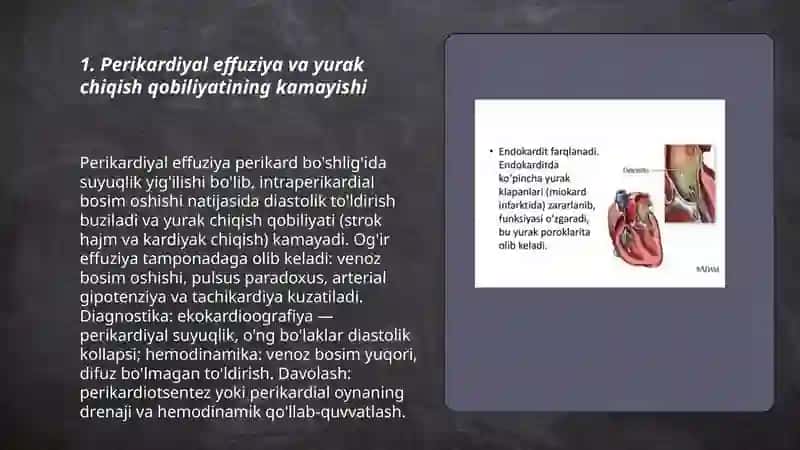 Perikard patologiyasida yurak funksiyasining buzilishi 3