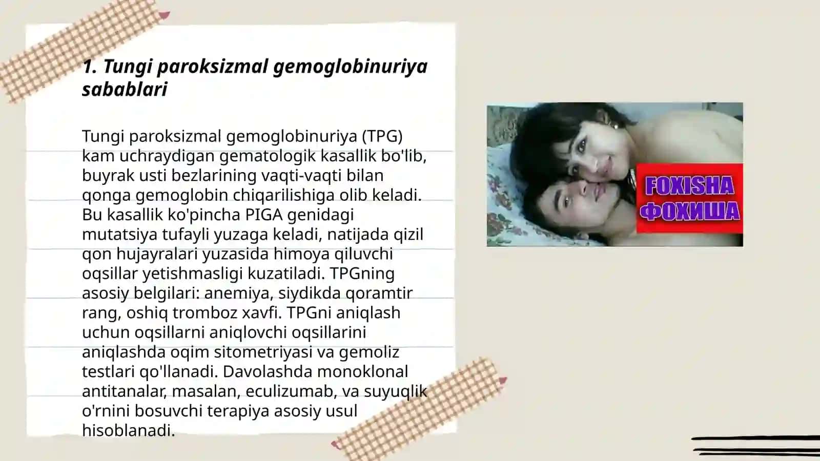 Tungi paroksizmal gemoglobinuriya 3