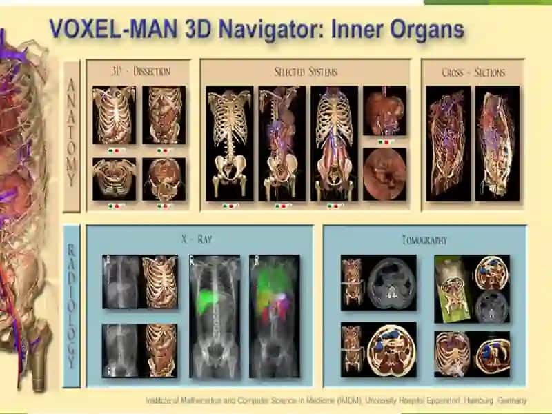 Neyroxirurgiyada qulga kiritilgan yutuqlar Kraniotomiya Vakranioplastika 3
