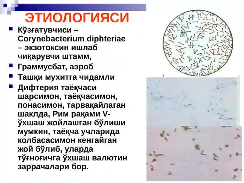 БЎҒМА – ДИФТЕРИЯ 3