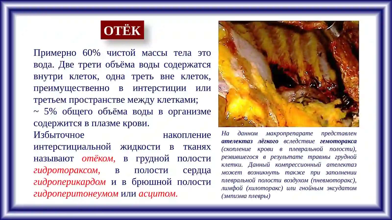 ПАТОЛОГИЧЕСКАЯ АНАТОМИЯ И СУДЕБНАЯ МЕДИЦИНА 3