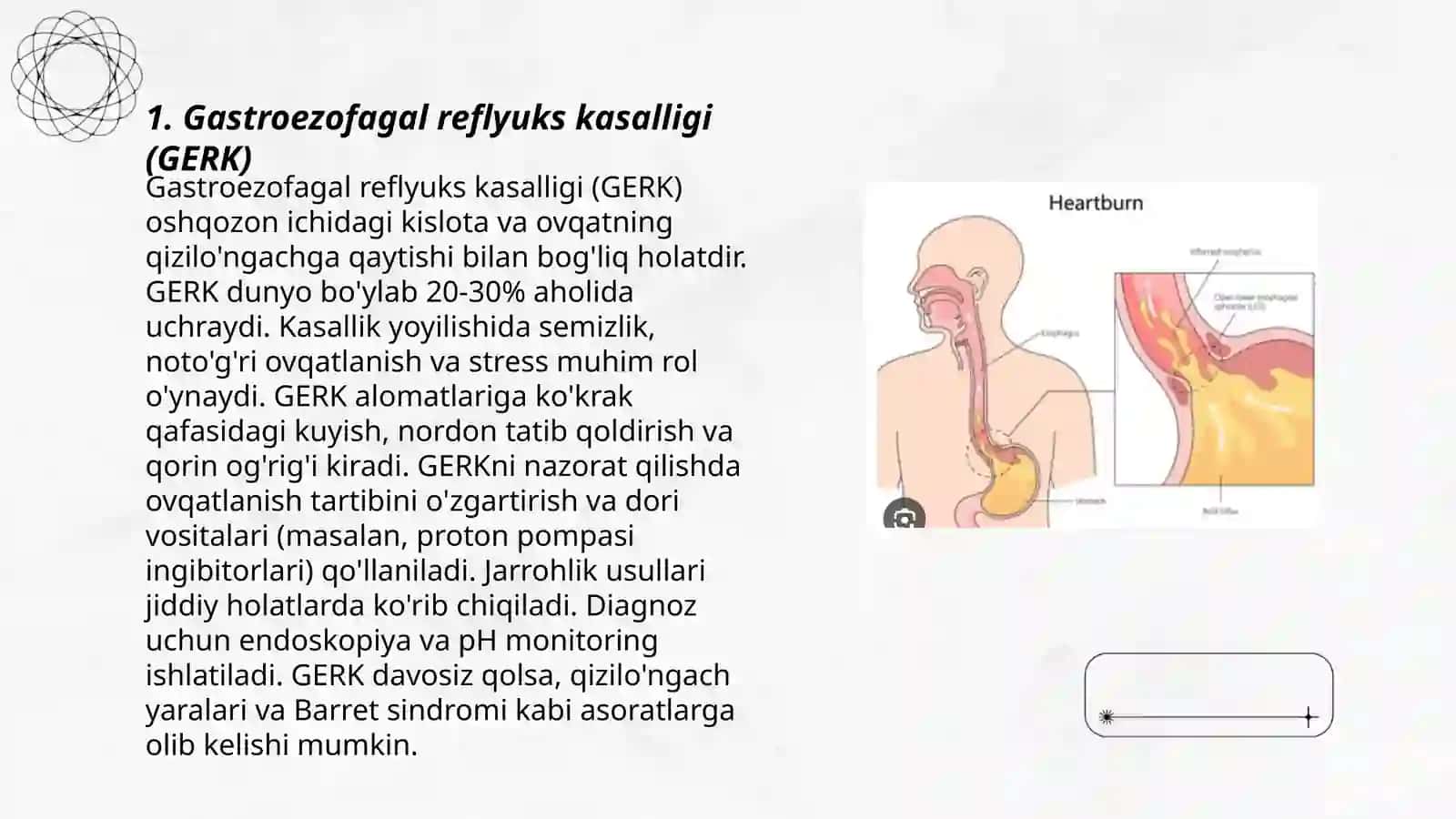 Gastroezofagal reflyuks 3