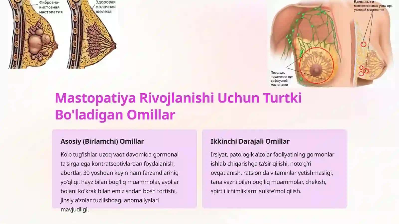 Mastopatiya — Alomatlari, Tasnifi, Sabablari, Tashxislash, Davolash, Oldini Olish 3