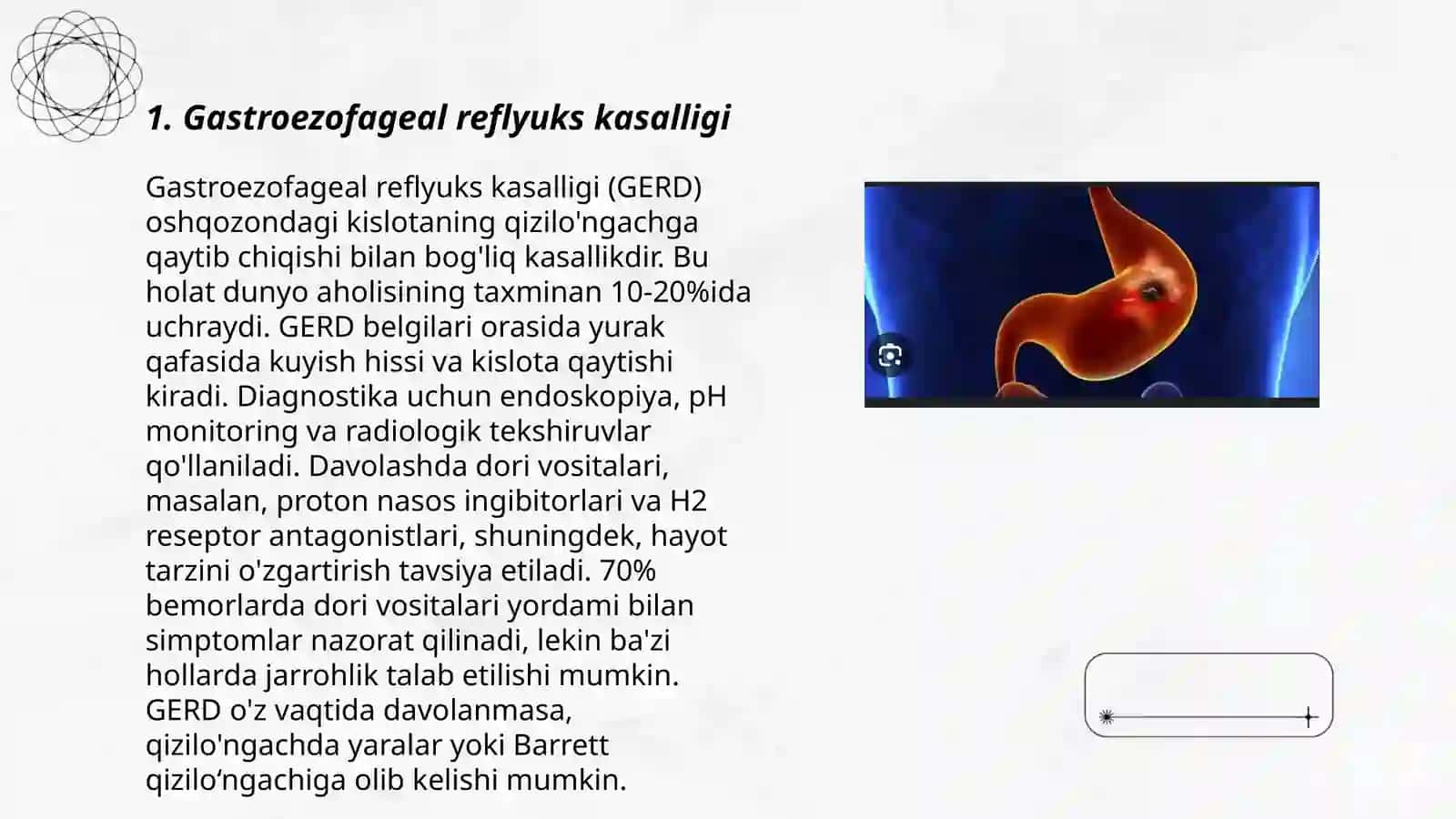 Gastroezofageal reflyuks kasalligi 3