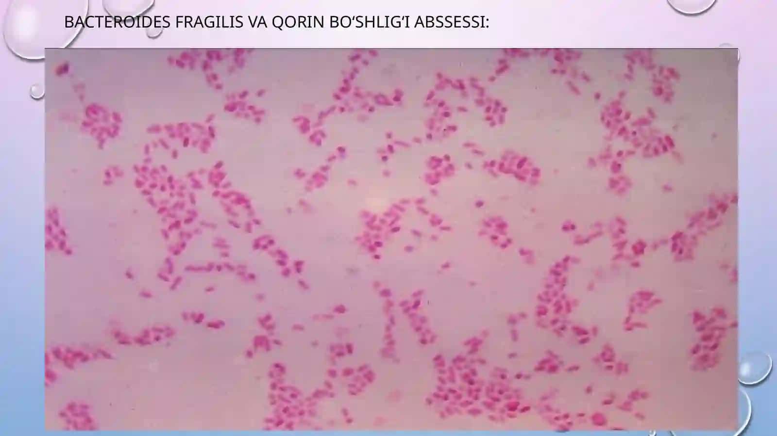 Patogen anaerob klostridial bo’lmagan infeksiya qo’zg’atuvchilari kasalliklari patogenezi 3