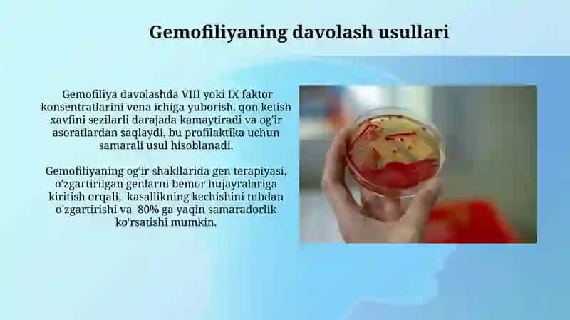 Gemofiliya davolash usullari 3