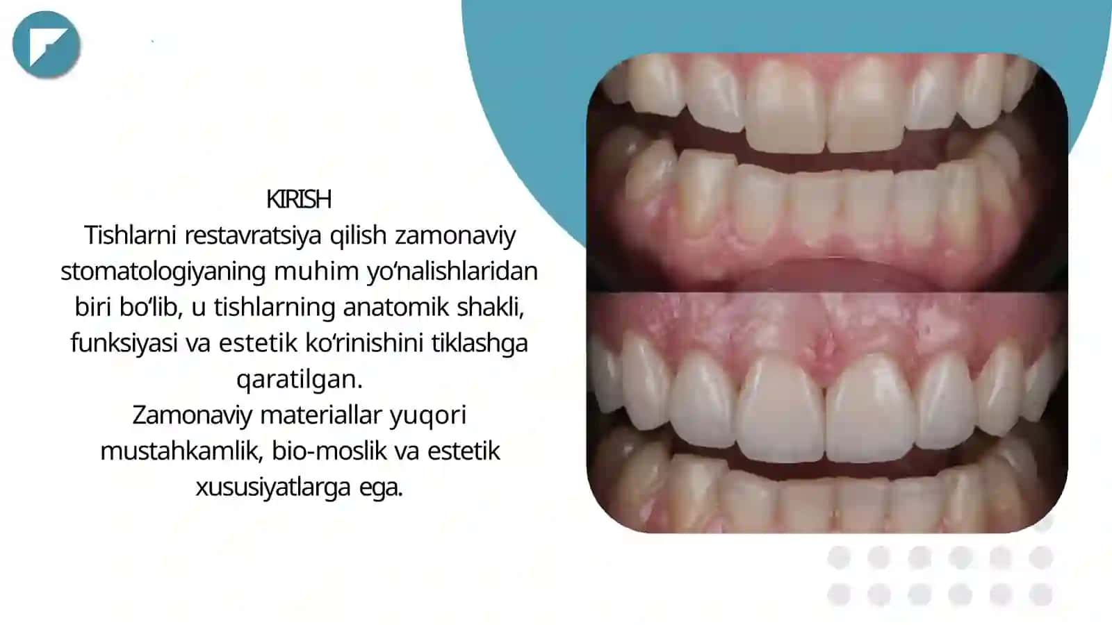 Abduraxmonova Zulxumorning KLINIK RESTAVRATSIYA STOMATOLOGIYA FANI DAN MÜSTAQILISHI 3