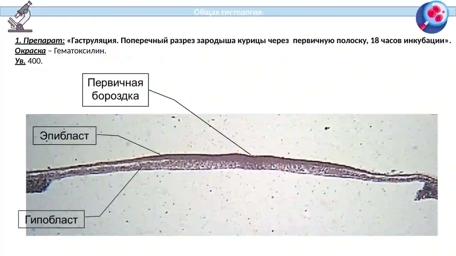 Гаструляция. Поперечный разрез зародыша курицы через первичную полоску, 18 часов инкубации 3