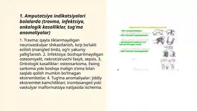 Bolalarda bajariladigan amputatsiya xususiyatlari 3