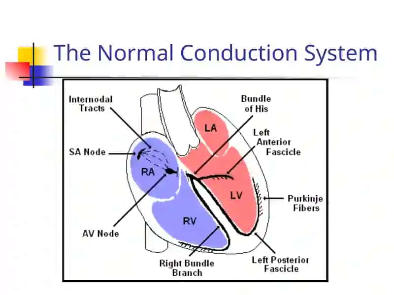 EKG Interpretation 3