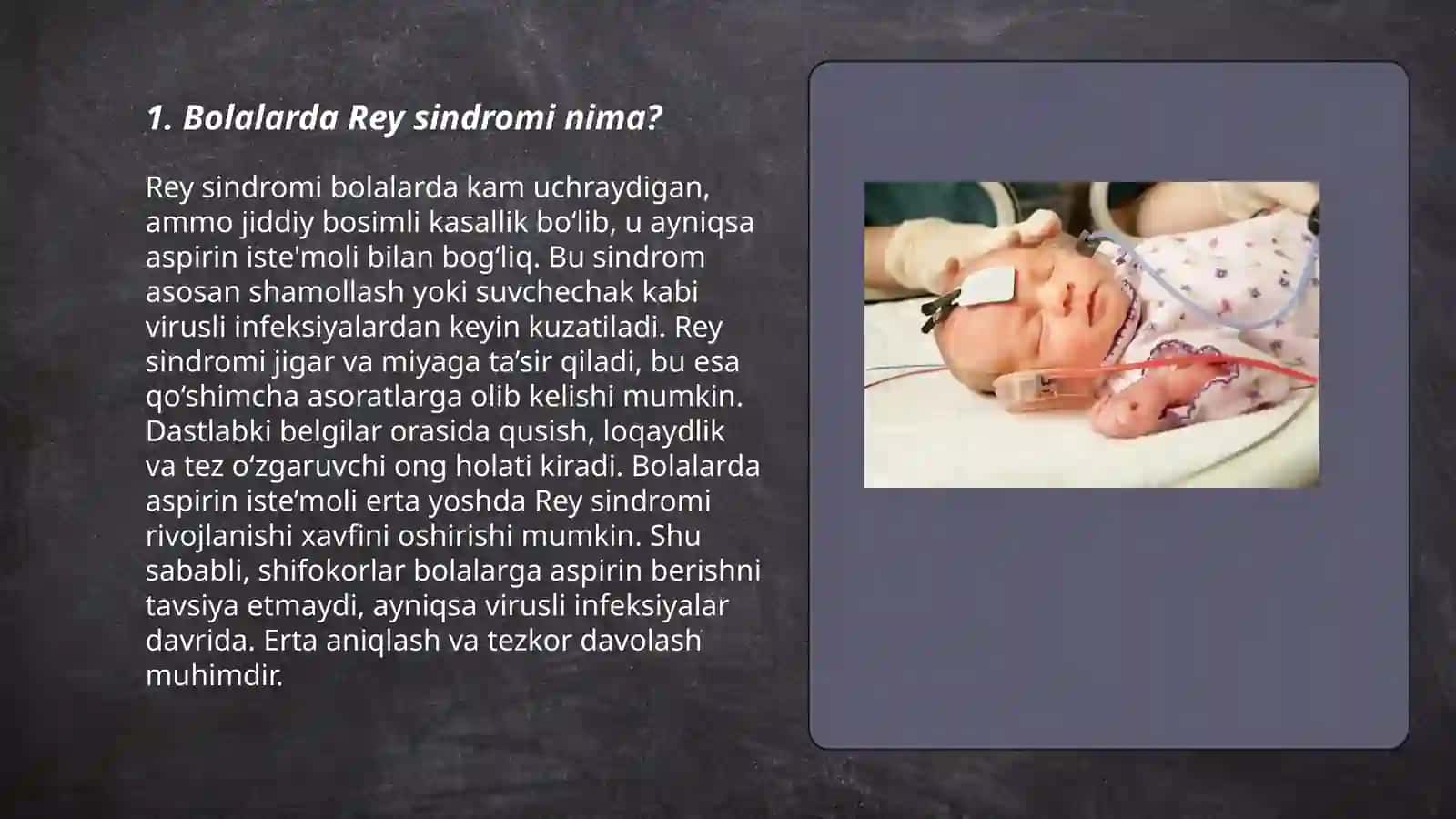Bolalarda Rey sindromi 3